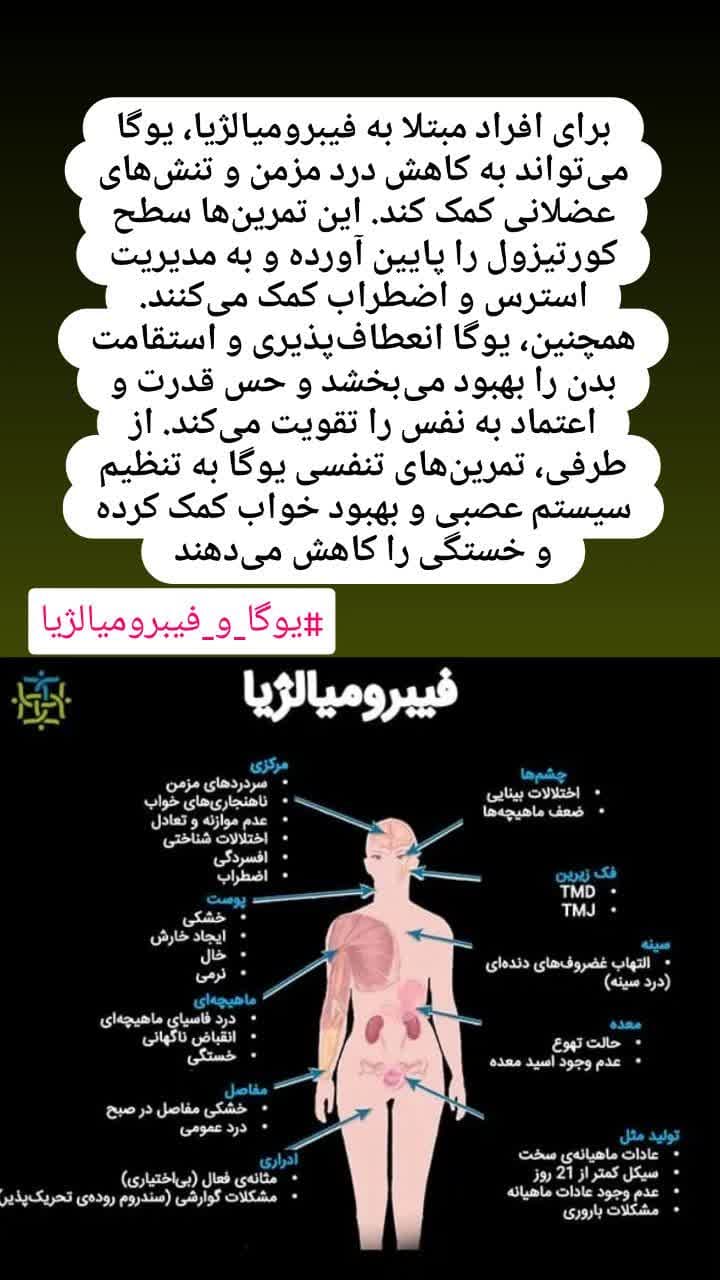درمان فیبرومیالژیا با یوگا -یوگا در کرج برای درمان فیبرومیالژیا